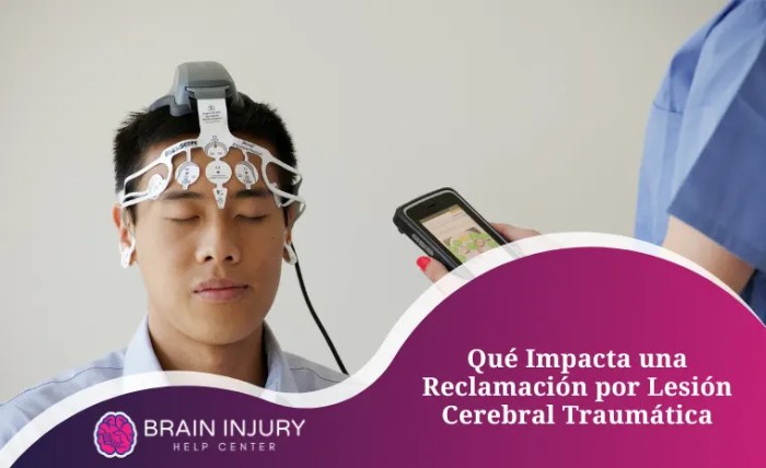 Qué esperar de una demanda por lesión cerebral traumática