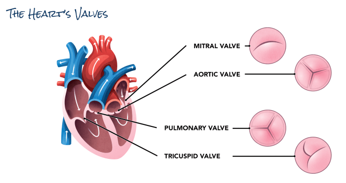 Valve Defects | Edwards Lifesciences